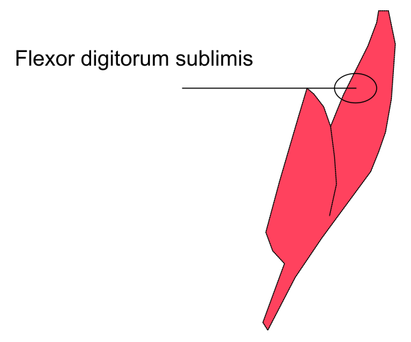 The image shows a simple line drawing of an abstract shape resembling a leaf with two curved lines forming its outline against a white background.