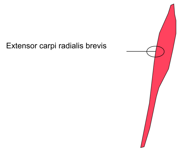 The image shows a diagram with annotations that include "EXTENSOR CARPI RADIALIS BREVIS" pointing to two different areas on what appears to be a medical illustration of human bones, specifically focusing on carpal structures in relation to radial and ulnar movements at the wrist.