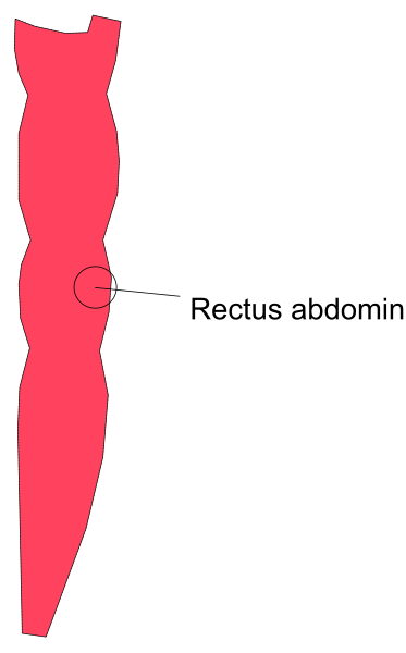 The image shows a red silhouette of an abdomen with text pointing to it that reads "Rectus Abdominis."