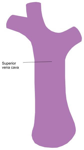 The image shows a purple bone with text indicating it's superior to another unseen bone labeled "superior".