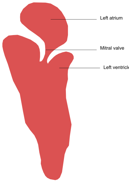 The image shows a red heart with labels indicating its parts: left atrium, right ventricle, mitral valve, tricuspid valve, septum secundarium (the dividing wall between the two sides of the heart), and membranous partitions on either side that separate it from other chambers.