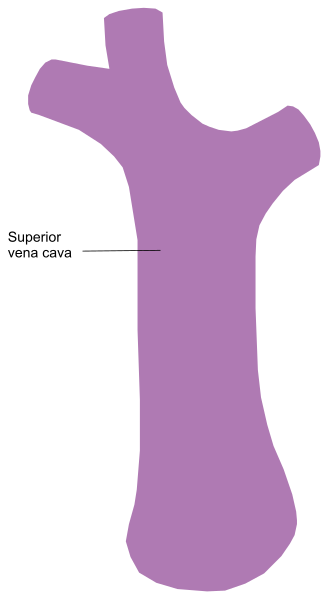 The image shows a purple outline of an object that resembles a tree trunk with branches extending outward from it against a white background on the left side.
