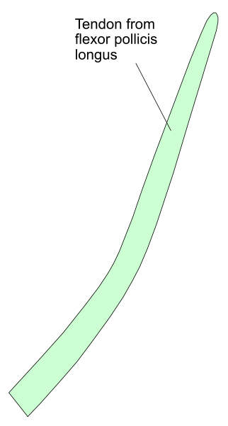The image shows a diagram of an object labeled "Tendon from flexor pollicis longus" with arrows pointing to different parts: proximal end (proximale), middle part (media) and distal end (distalis).