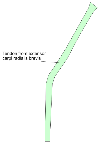 The image shows a diagram of an object labeled "tendon from extensor carpi radialis brevis" with arrows pointing to different parts like radius, ulna, scaphoid, lunate, and capitate bones in what appears to be a human hand or wrist area against the background that looks like skin.