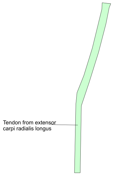 The image shows a diagram of an object labeled "tendon from extensor carpi radialis longus" with arrows pointing to different parts such as tendons, ligaments, cartilage, bone and muscle fibers in various shades of gray against white background.