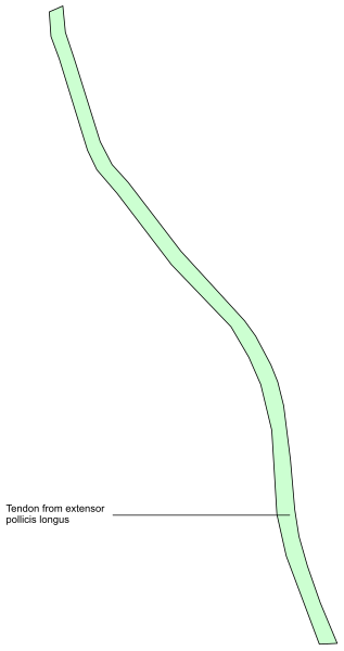 The image shows a simple line drawing of an object that resembles a long green snake with two small black dots at each end on what appears to be white paper against a gray background.
