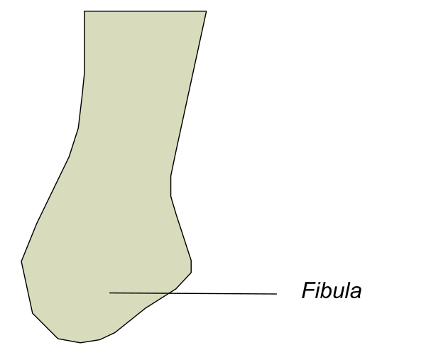 The image shows a black and white illustration of an object that appears to be a sock with text indicating it is "fibula" on one side and has been labeled as such in another language below it, suggesting this might represent a medical diagram related to human anatomy or orthopedics.