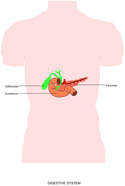 The illustration shows a human torso with an enlarged stomach labeled "gastritis" on it, indicating some form of digestive system issue such as gastric ulcer or inflammation.