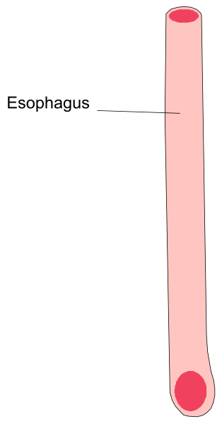 The image shows a diagram with two vertical bars labeled "esophagus" on top of each other against a white background; one bar is red while the other has no color information provided in this description.