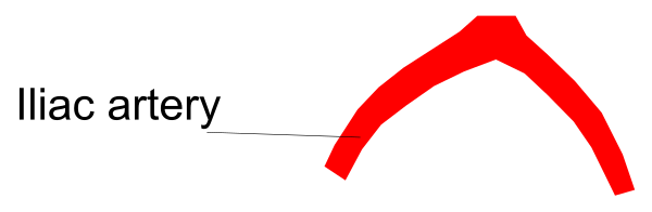 The image shows a meme with text that reads "I have lactose intolerance" accompanied by an arrow pointing to it from another part of the picture labeled as "lactac artery."