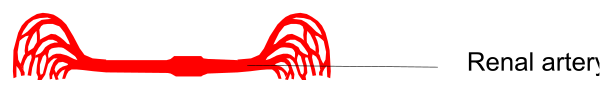 The image shows a red squiggly line with text that reads "Renal" on it against a grey background.