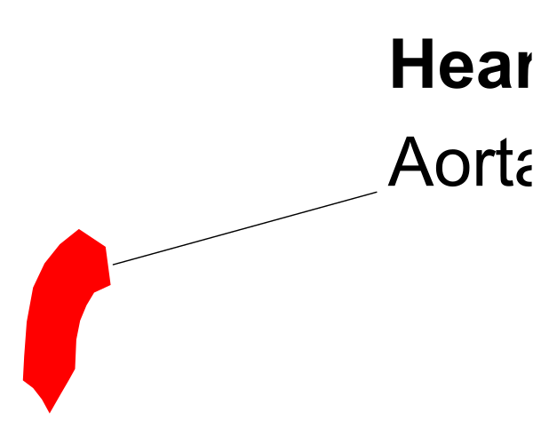 The image shows a simple graphic with text that reads "I HEART AORTA" on top of an illustration resembling a heart shape in red color against a white background at the bottom right corner, and there is also some additional smaller text above it which appears to be upside down.