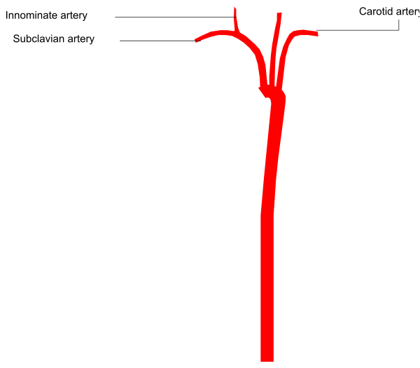 The image shows a simple diagram with two arrows pointing to different locations on what appears to be an atlas of Africa: one arrow points towards "Subsaharan" labeled in red text above it, while another arrow is marked as "nominate," indicating that this location has been selected or highlighted.