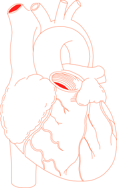 The image shows a black and white line drawing of an open human heart with visible internal structures such as valves and chambers, set against a dark background.