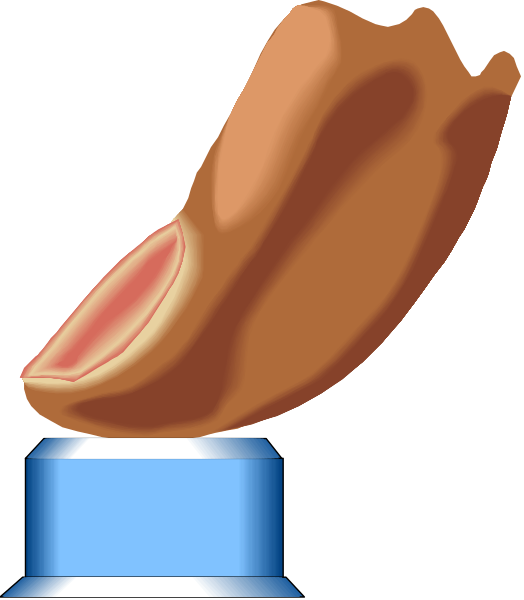 The image shows a cartoon depiction of an open can with its contents spilling out onto what appears to be a hot dog bun on top of it.