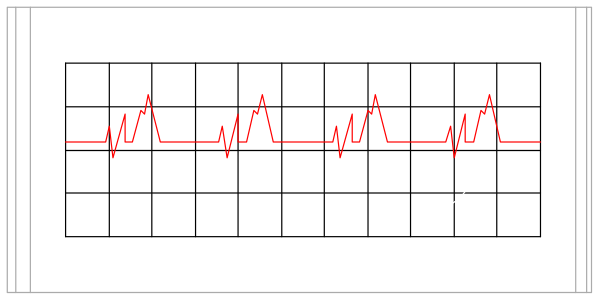 The image shows a graph with red lines on it displayed within an open laptop computer screen that is placed inside what appears to be a room with white walls.