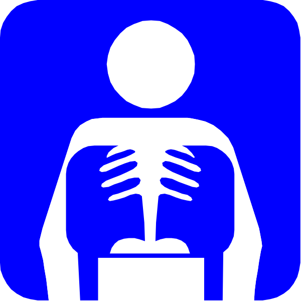 The image shows a blue icon with white outlines depicting an X-ray of a human torso on top of which is superimposed a silhouette of a person sitting in front of it, suggesting that this could be part of medical equipment or software interface for viewing and analyzing x-rays.