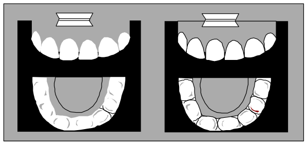 The image shows a set of four teeth with different expressions: two smiling, one frowning, and another showing its tongue sticking out in an open mouth.