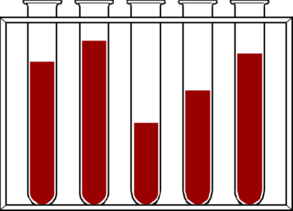 The image shows a black and white checkered pattern with red squares on it that resemble blood cells under a microscope slide.