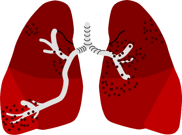 The illustration shows a pair of lungs with red polka dots on them against a black background; it is stylized to resemble clip-art.
