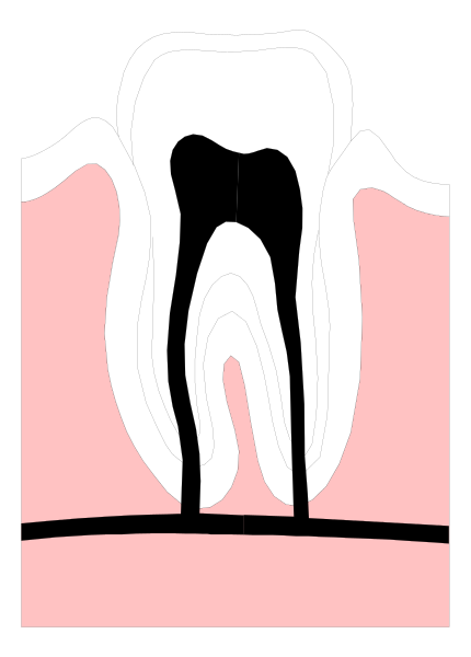 The image shows a cartoon of an open mouth with teeth inside it against a pink background on top right corner; below is another smaller picture showing two white front teeth in profile view next to each other within what appears to be lips, suggesting that this could represent dental care or oral hygiene education.