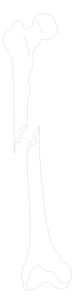 The image shows a black and white photo of two skeletons standing side by side with their backs to each other against an indistinct background.