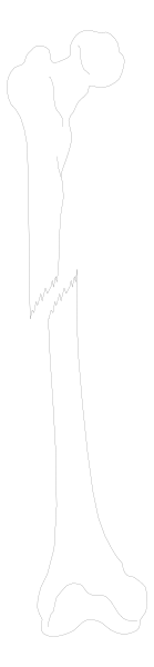 The image shows a black and white photo of two skeletons standing side by side with their backs to each other against an indistinct background.