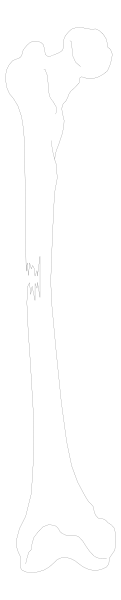 The image shows a black and white illustration of two bones with joints on either end placed side by side against a gray background.